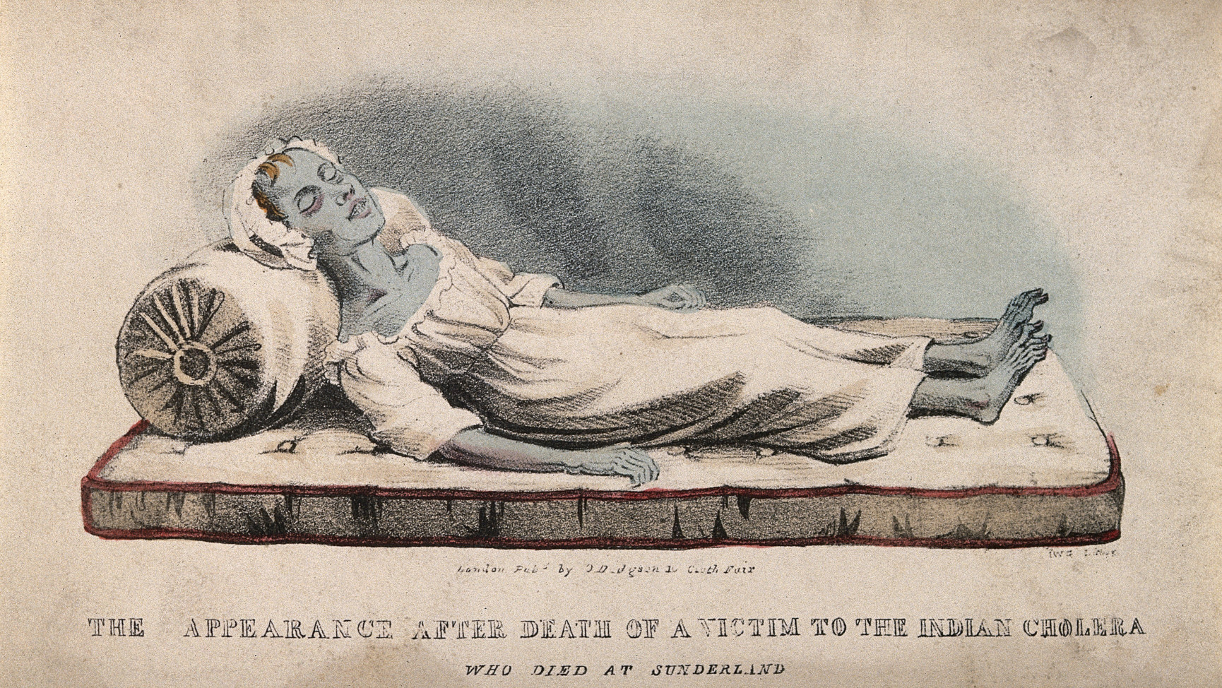 Una vittima del colera in una stampa a Sunderland nell’Inghilterra del Nord-Est, 1832. (fonte wellcomecollection.org).